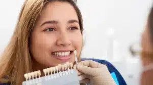 Dental Veneers